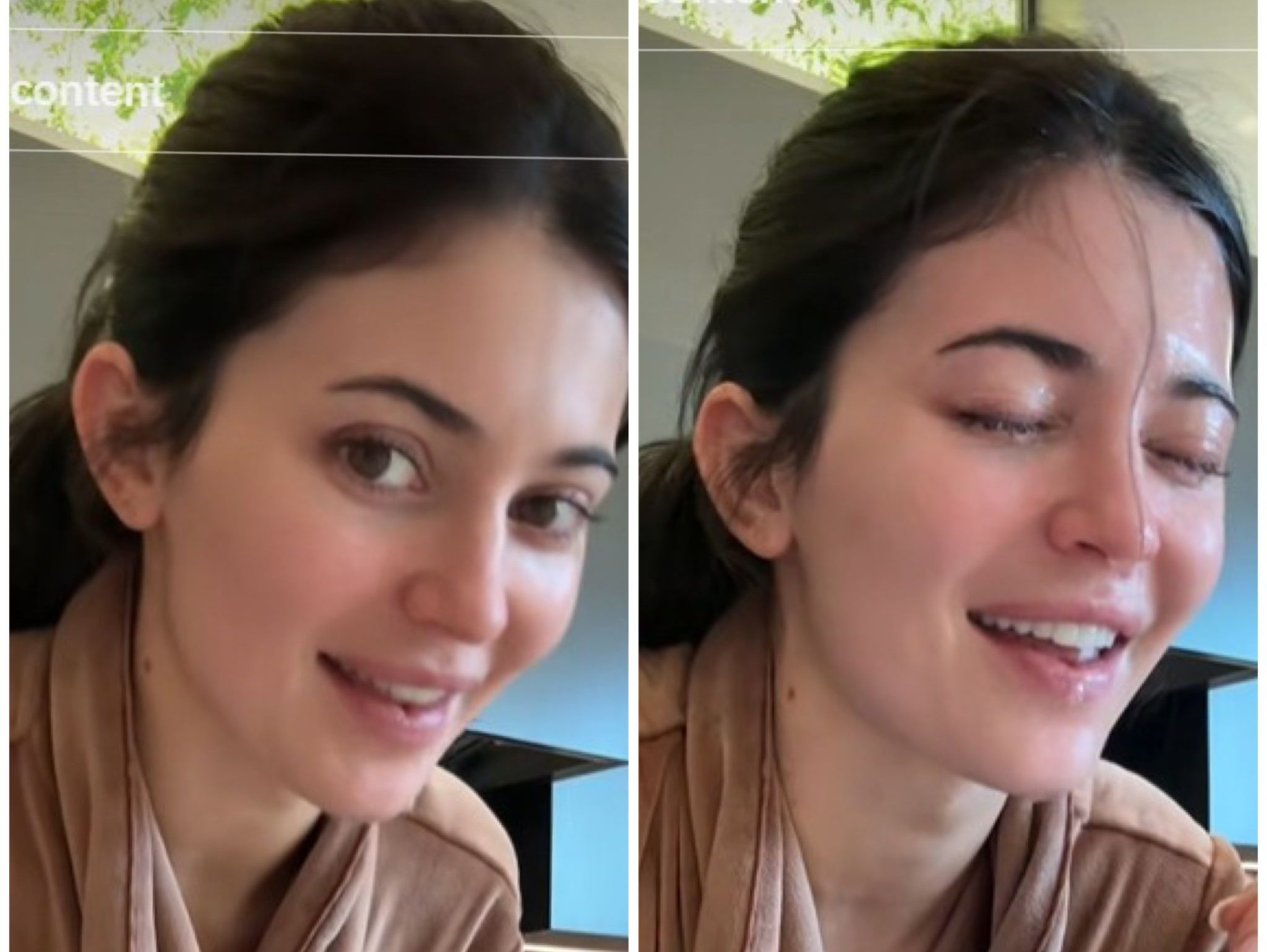 Кайли Дженър се подложи на тази болезнена процедура за красота преди наградите „Златен глобус“