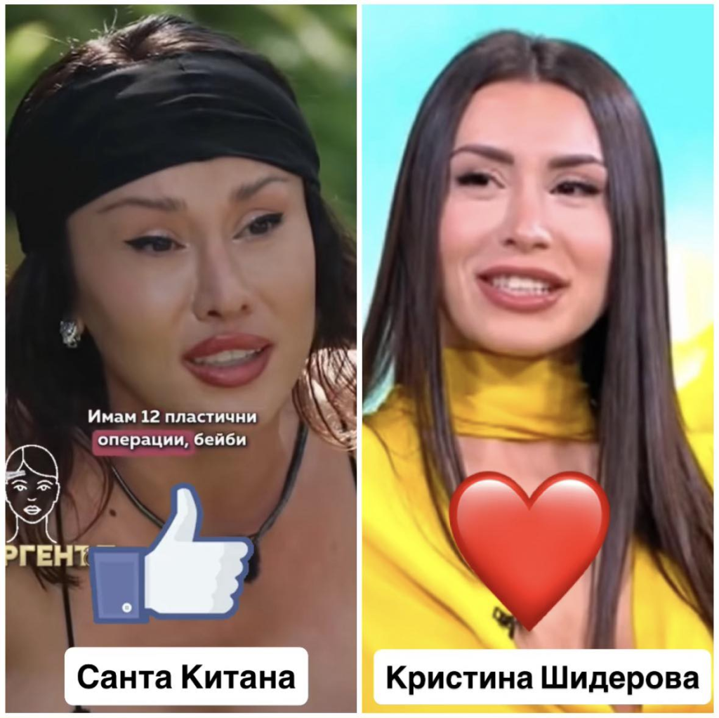 Санта Китана си сложила пирони в главата, за да си повдигне очите: „Най-болезнената операция“